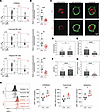 Evaluation of NK cell mitochondrial health.