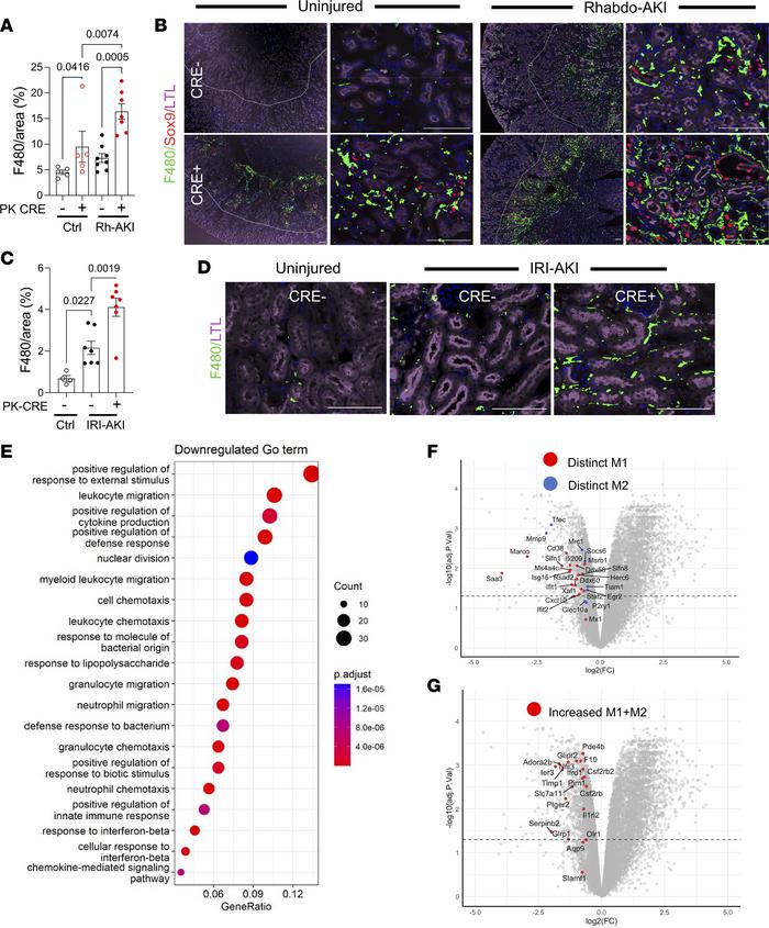 Increased renal macrophages with a reduced proinflammatory signature in ...
