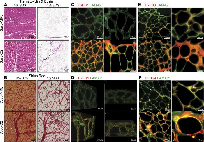 Reduction in TGF-β proteins in decellularized matrices from Sgcg-MRL mus...