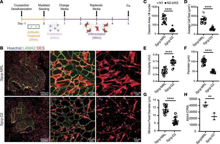 Decellularized myoscaffolds from Sgcg-MRL muscle promote migration and e...