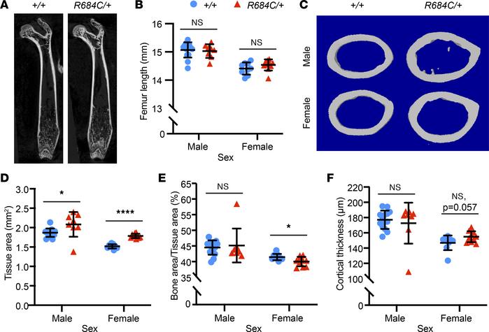
Ezh2R684C/+ mice have altered cortical bone parameters.
(A) μ-CT of Ezh...
