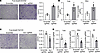 Targeted methylation at the Esr1 promoter in adipocytes regulates macrophag