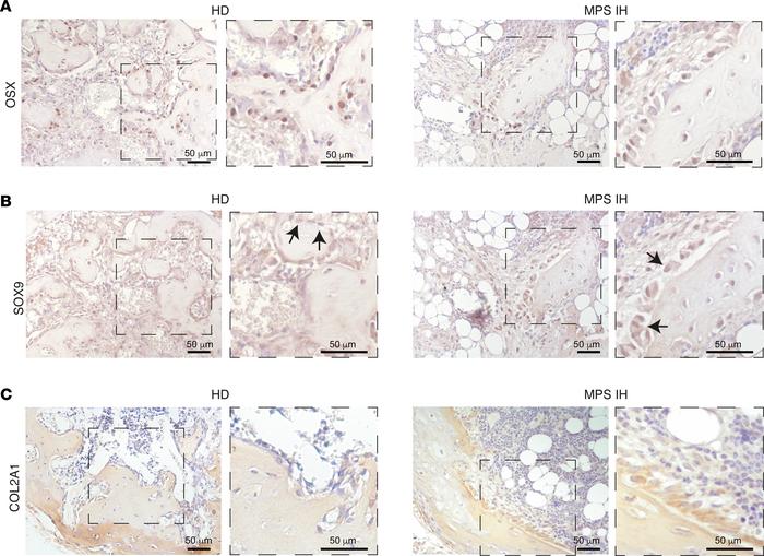 Bone-forming cells in HD and MPS IH ossicles.
(A–C) Immunolocalization o...