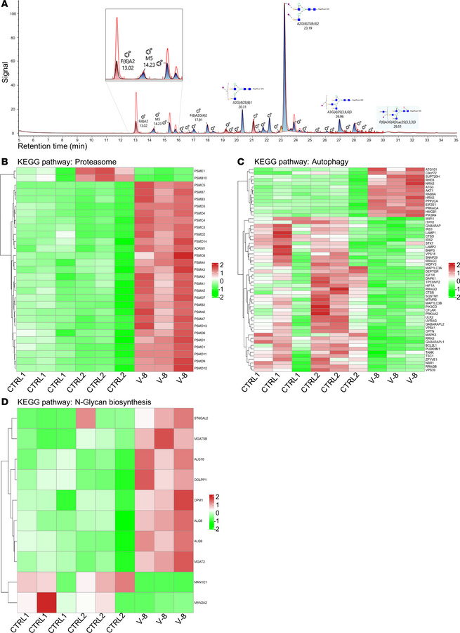 The c.333del variant affects sugar processing as well as several importa...