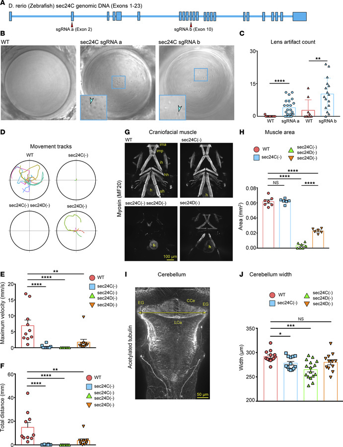 
Sec24C CRISPR-edited zebrafish larvae present with lens damage, motilit...
