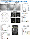 Sec24C CRISPR-edited zebrafish larvae present with lens damage, motility im