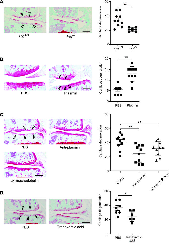 Genetic deficiency or pharmacological blockade of plasmin attenuates OA ...