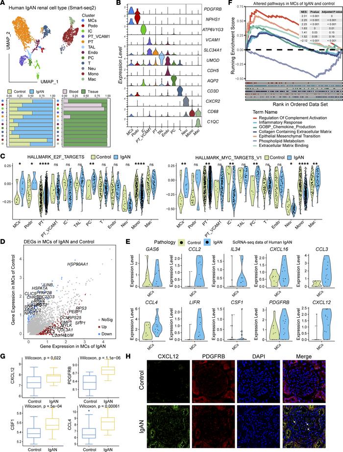 Single-cell transcriptomic architecture in human IgAN.
(A) Uniform manif...