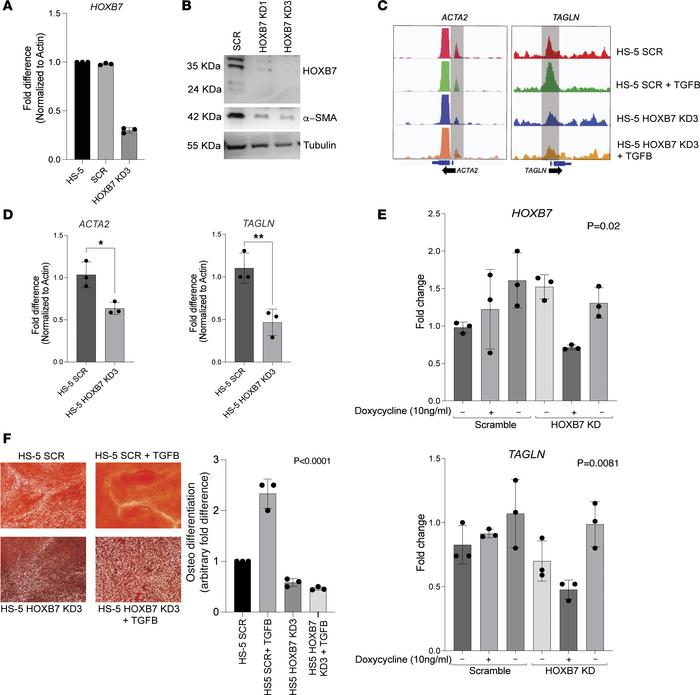 Knockdown of HOXB7 gene alters the potential of MSCs for osteodifferenti...