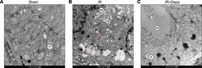 Ten days after AKI, dapagliflozin abrogates ultrastructural abnormalitie...