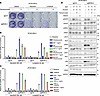 Combination therapy with EGFR inhibitors and ALK-TKIs can overcome the resi