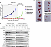 MIG6 depletion confers resistance to ALK inhibitors in vivo.