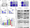 MIG6 depletion confers resistance to ROS1-TKIs in ROS1-rearranged NSCLC cel