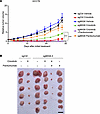 Antitumor effect of ROS1-TKIs in the HCC78 xenograft MIG6 depletion model.