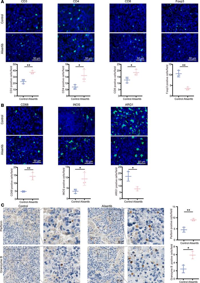 AURKA inhibitors affect immune cell infiltration and activation in gliom...