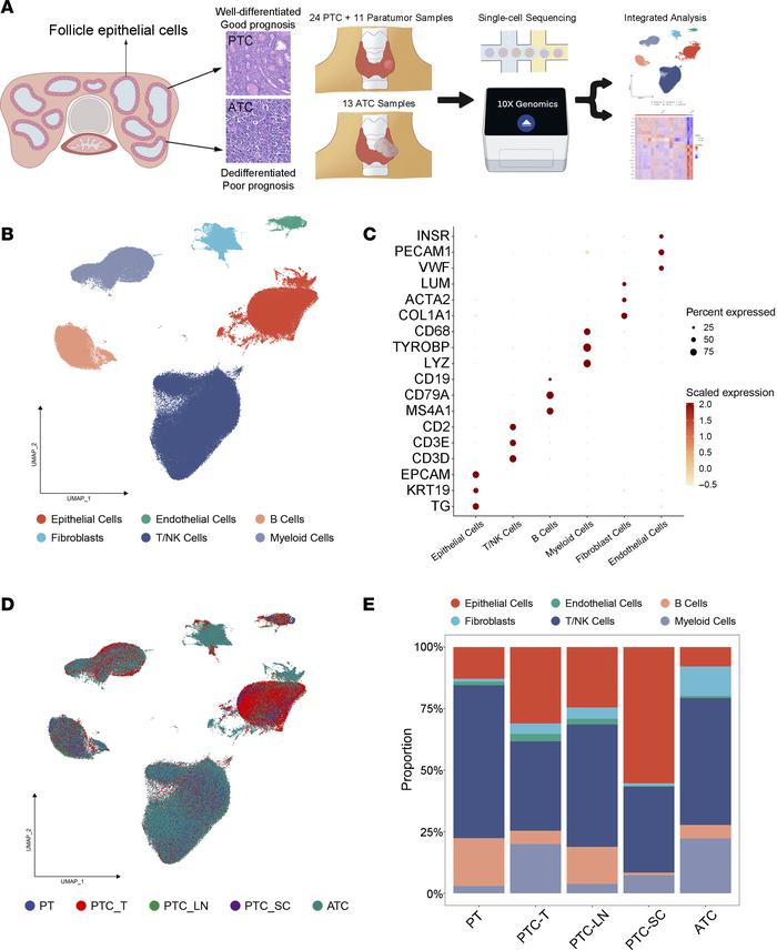 Overview of the TME in PTC and ATC at single-cell resolution.
(A) Workfl...