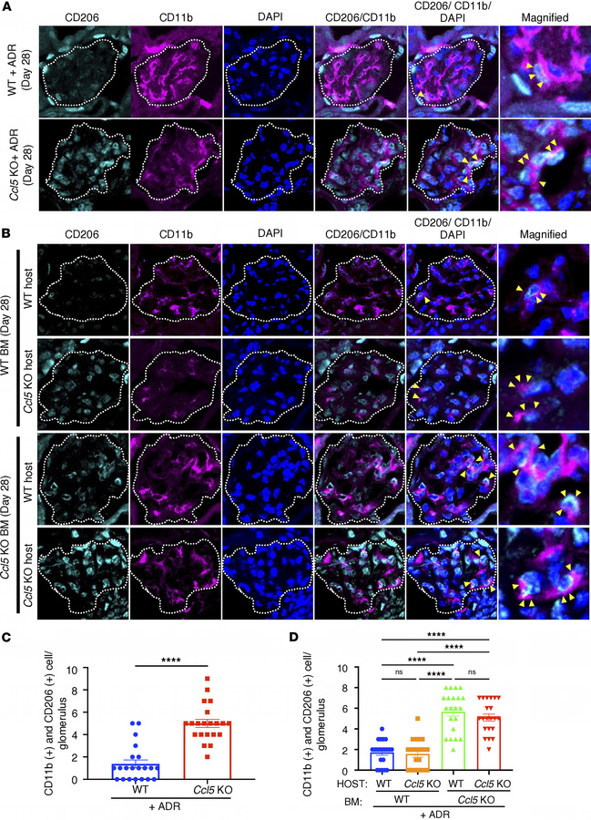 CCL5 in BM-derived cells limits glomerular M2 macrophage accumulation in...