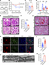The effect of CCL5 deficiency in ADR-induced nephropathy mice.