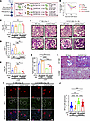 The effect of CCL5 deficiency in BM-derived cells on ADR-induced nephropath