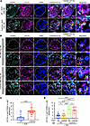 CCL5 in BM-derived cells limits glomerular M2 macrophage accumulation in AD