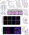 CCL5 in macrophages exacerbates ADR-induced nephropathy by limiting glomeru