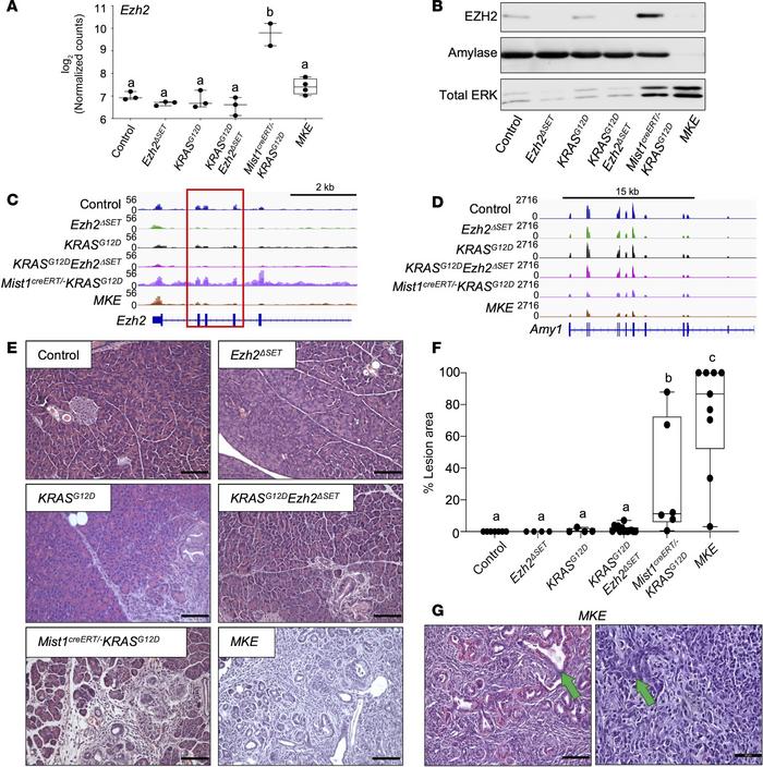 Combined loss of MIST1 and EZH2ΔSET promotes rapid loss of acinar tissue...