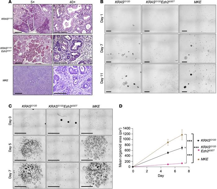 
EZH2ΔSET deletion has different cell autonomous roles depending on the ...