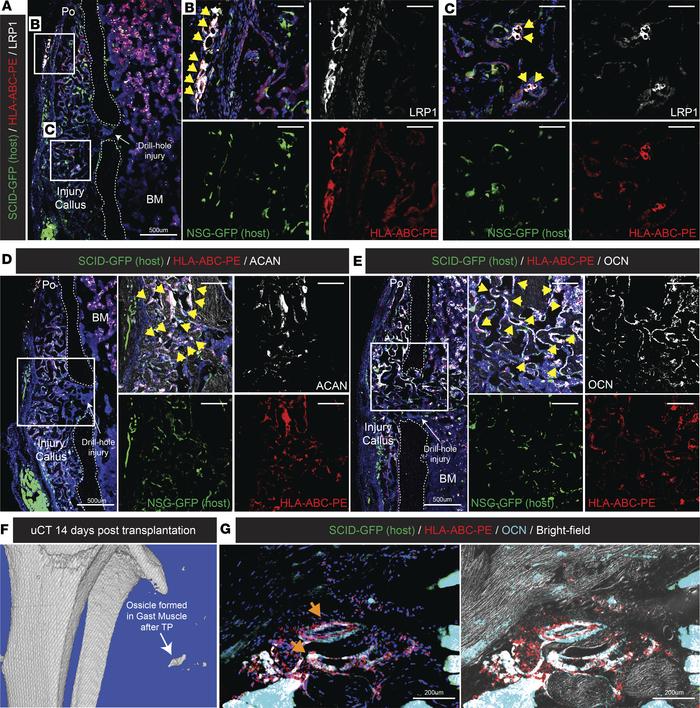 LRP1+CD13+ human P-SSCs engraft and possess osteochondrogenic differenti...