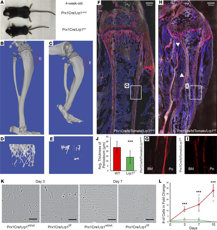 Conditional deletion of Lrp1 in Prx1+ cells leads to skeletal dysplasia....