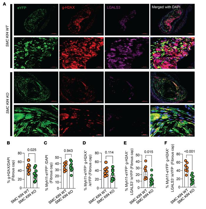 SMC-Klf4 KO resulted in a marked reduction of SMC-derived and non–SMC-de...