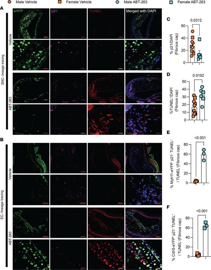 ABT-263 treatment (100mg/kg/bw) of SMC (Myh11-CreERT2-eYFP) and EC (Cdh5...