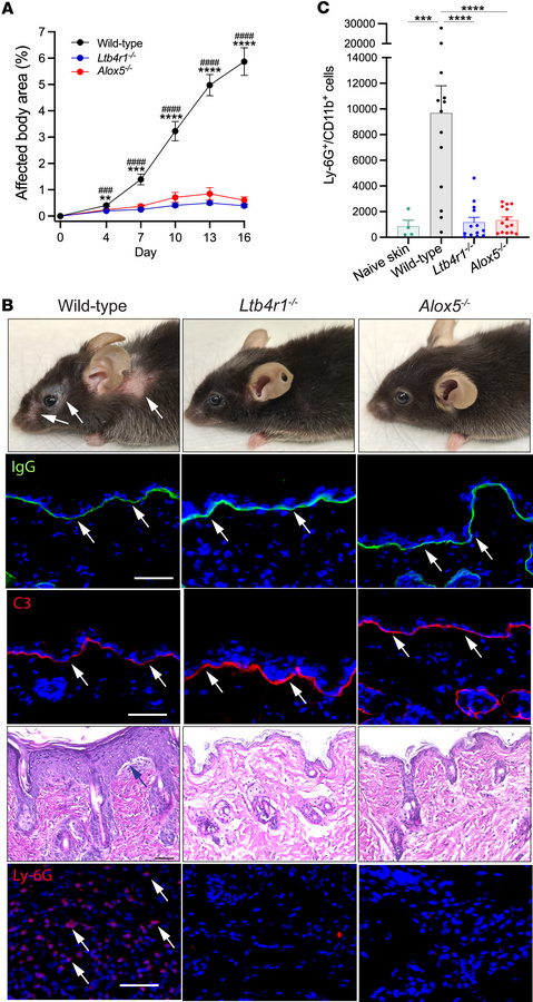 Genetic deficiency in 5-lipoxygenase or BLT1 confers resistance to the e...