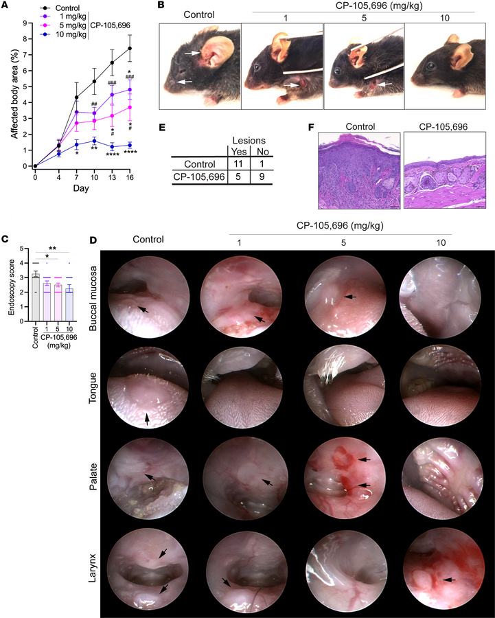 The BLT1 antagonist CP-105,696 ameliorates mucocutaneous inflammation in...