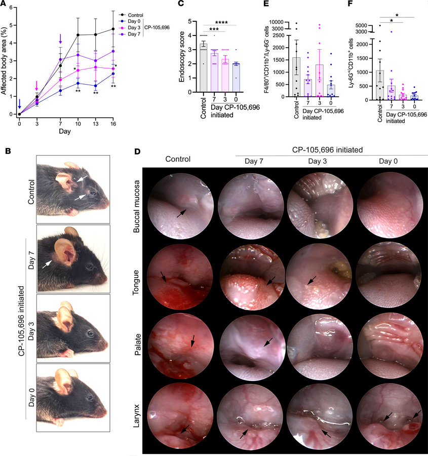 The BLT1 antagonist CP-105,696 disrupts the progression of mucocutaneous...