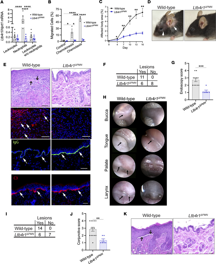 Neutrophil-specific Ltb4r1–/– (Ltb4r1ΔPMN) mice are protected from mucoc...