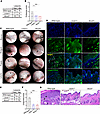 Oropharyngeal and conjunctival mucosal lesions are reduced in Alox5–/– and