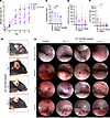 The BLT1 antagonist CP-105,696 disrupts the progression of mucocutaneous in