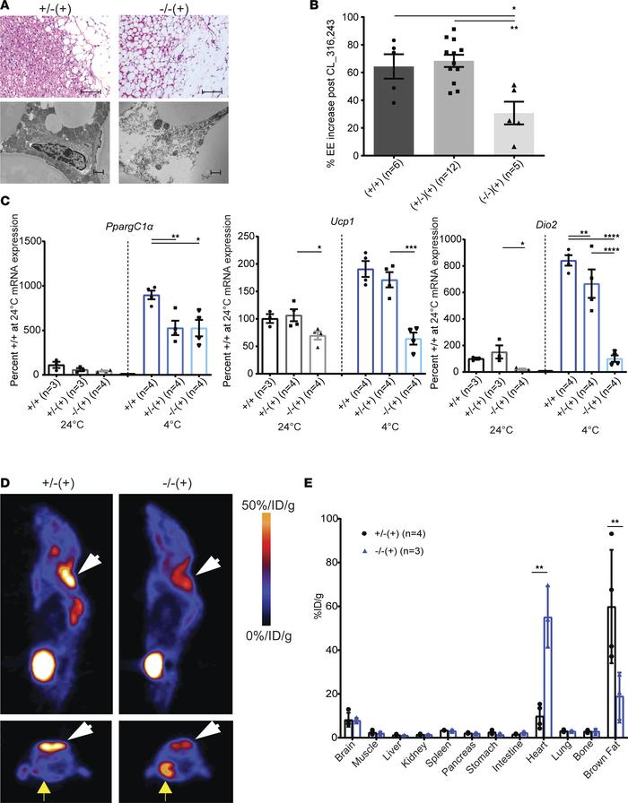 MMA mice display cold intolerance associated with abnormal brown fat pat...
