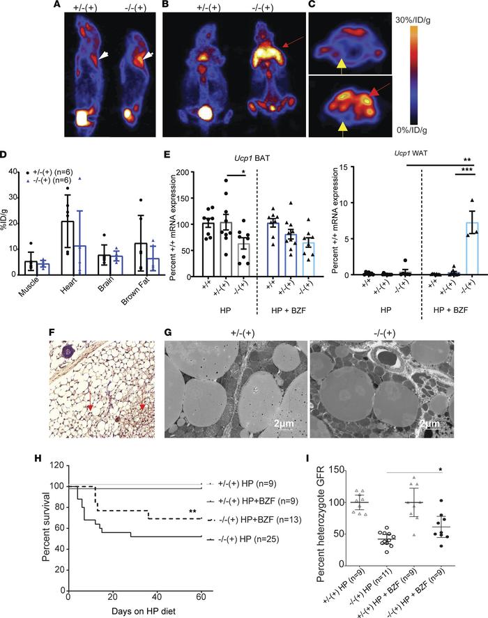 Bezafibrates reverse the brown fat mitochondrial dysfunction of mutant m...