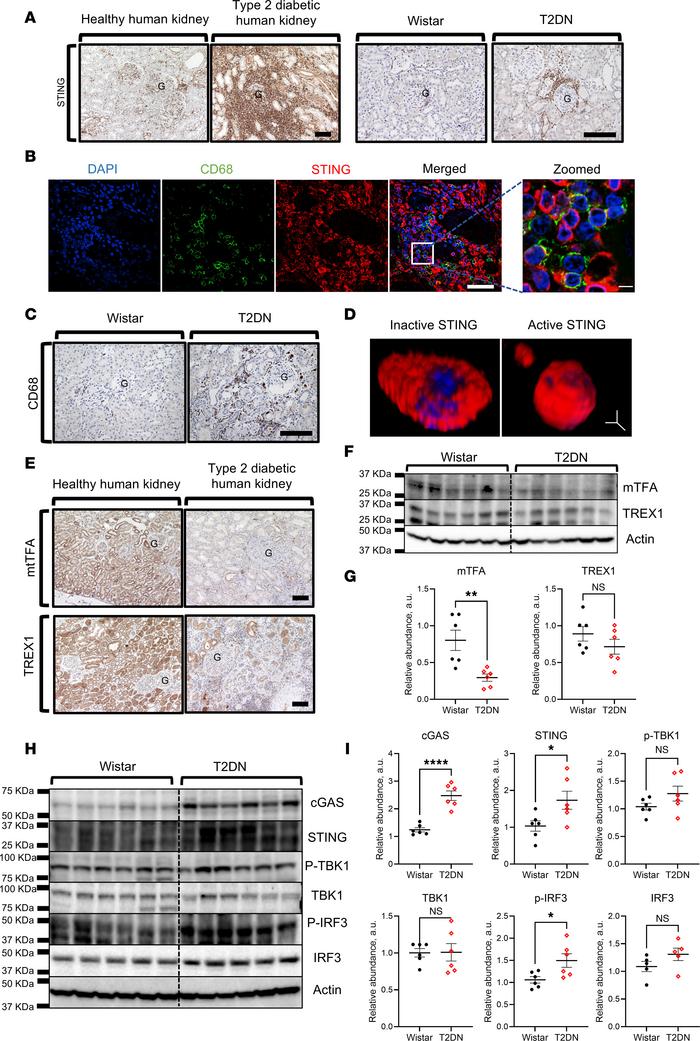 The expression pattern of cGAS/STING pathway molecules, TREX1 and mtTFA,...