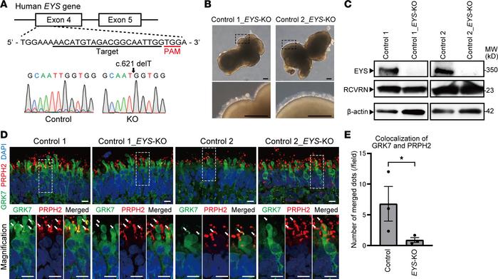 Generation of EYS-KO iPSCs with CRISPR/Cas9 system.
(A) Target sequence ...