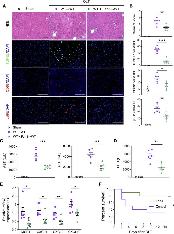 Inhibition of ferroptosis during liver cold storage mitigates the hepato...