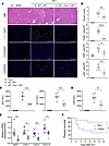 Inhibition of ferroptosis during liver cold storage mitigates the hepatocel