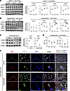 Cold stress enhances ER stress, MICU1, MDA, and NRF2 expression in LSEC cul