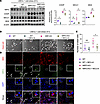 MICU1 inhibition reduces cold stress–induced ferroptotic cell death and MDA