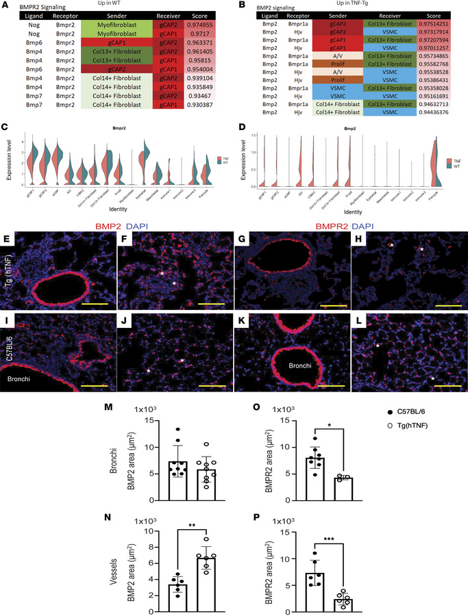 Ligand-receptor analysis demonstrates prominent role of altered BMP sign...