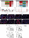 Ligand-receptor analysis demonstrates prominent role of altered BMP signali