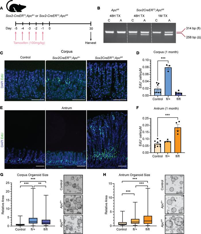 Gastric region–specific proliferation in FAP mouse model.
(A) Adult Sox2...