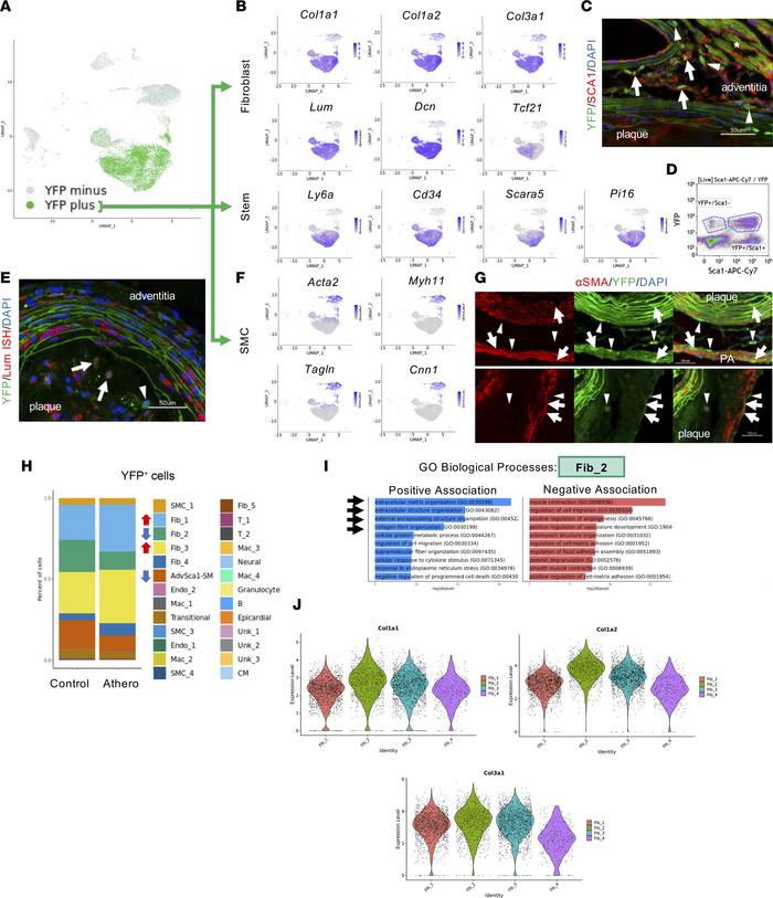 AdvSca1-SM cells differentiate into fibroblasts or SMCs or remain in a s...