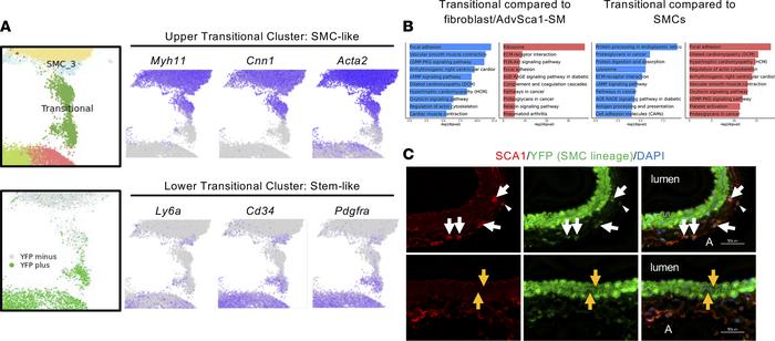 Dynamic, bidirectional differentiation between AdvSca1-SM cells and SMC ...